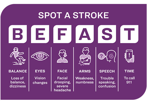 Spot a Stroke with BEFAST