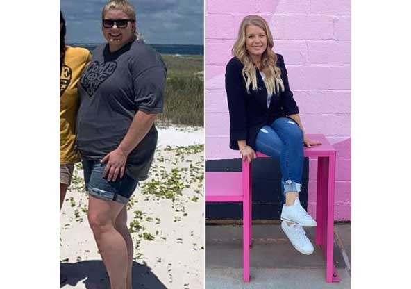 Sarah's before and after weight loss surgery